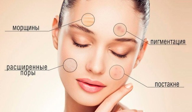 Carboxiterapia - o que é isso em medicina e cosmetologia, avaliações, preço