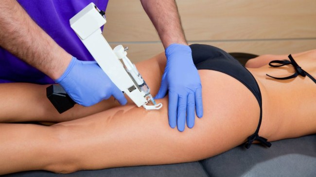 Carboxiterapia - o que é isso em medicina e cosmetologia, avaliações, preço