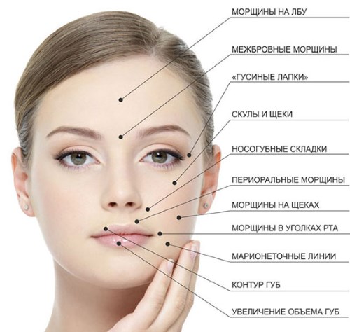 Relatox atau Botox - yang mana lebih baik? Perbandingan Suntikan Suntikan Kecantikan