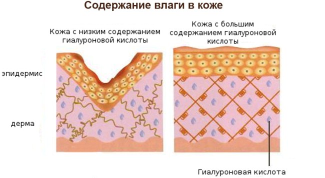Tiêm axit hyaluronic cho mặt (môi, dưới mắt, trán). Ảnh trước và sau