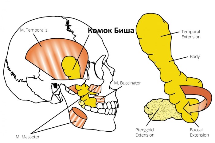 Lũ Bisha. Nó là gì, làm thế nào để loại bỏ nó, một hoạt động, làm thế nào để làm sạch nó tại nhà