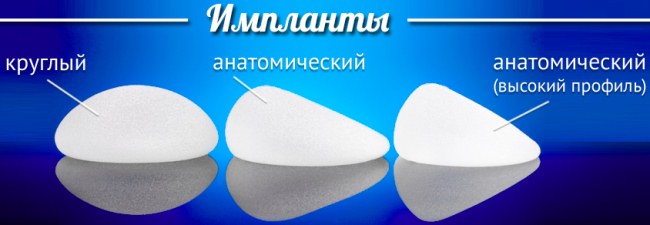 Mammoplasty - การผ่าตัดนี้คืออะไรก่อนและหลังภาพถ่ายพร้อมคำอธิบายบทวิจารณ์