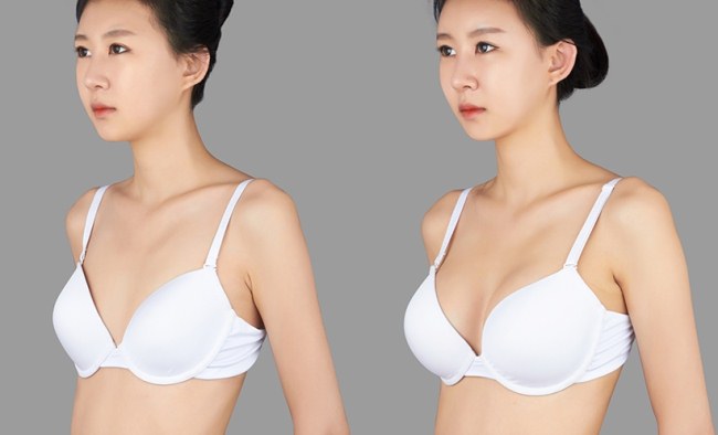 Mát xa để làm nở ngực trong 3 ngày. Video cách làm tại nhà