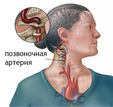 Вежбе доктора Шишонина за врат са остеохондрозо. Гимнастички комплекс, видео