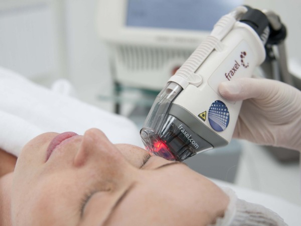 Blepharoplasty - nó là gì, nó diễn ra như thế nào, trước và sau khi chụp ảnh