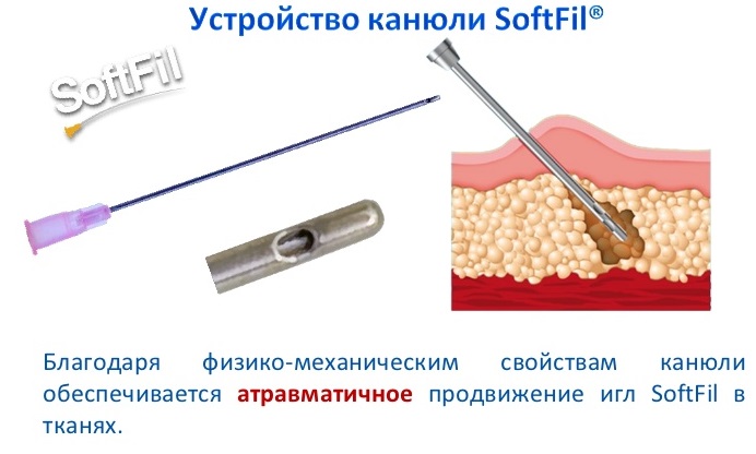 Cannula trong thẩm mỹ và y học