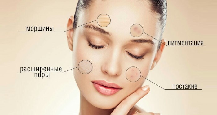 Carboxytherapy - rawatan muka, suntikan gas untuk punggung dan sendi, untuk osteochondrosis