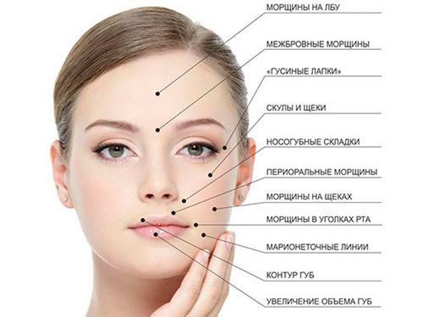 ฟิลเลอร์ครีม - มันคืออะไรวิธีการใช้ฟิลเลอร์ Libriderm สำหรับริ้วรอยลึก บทวิจารณ์