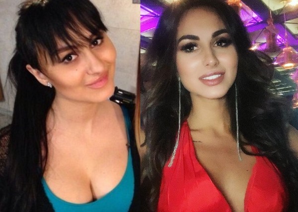 ليرا فروست. صور قبل وبعد عمليات تجميل الانف والشفاه والصدر
