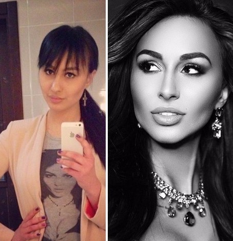 ليرا فروست. صور قبل وبعد عمليات تجميل الانف والشفاه والصدر