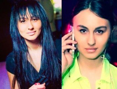 ليرا فروست. صور قبل وبعد عمليات تجميل الانف والشفاه والصدر