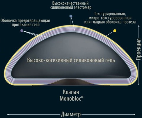 Мамопластика - пластична хирургија млечних жлезда. Фотографије пре и после, трошкови, прегледи