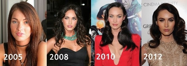 ميغان فوكس قبل وبعد عمليات تجميل الوجه. صورة عندما أجريت جراحة تجميل على الشفاه والعينين والأنف وعظام الخد