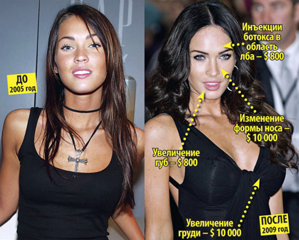 ميغان فوكس قبل وبعد عمليات تجميل الوجه. صورة عندما أجريت جراحة تجميل على الشفاه والعينين والأنف وعظام الخد