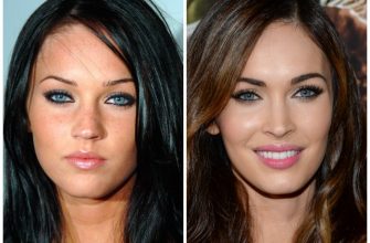 Megan Fox ก่อนและหลังการทำศัลยกรรมใบหน้า รูปถ่ายตอนทำศัลยกรรมริมฝีปากตาจมูกโหนกแก้ม