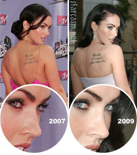 ميغان فوكس قبل وبعد عمليات تجميل الوجه. صورة عندما أجريت جراحة تجميل على الشفاه والعينين والأنف وعظام الخد