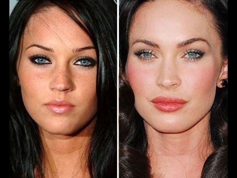 ميغان فوكس قبل وبعد عمليات تجميل الوجه. صورة عندما أجريت جراحة تجميل على الشفاه والعينين والأنف وعظام الخد