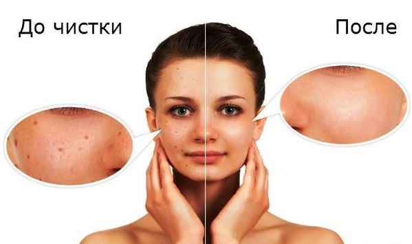 Làm sạch mặt cơ học: siêu âm, thủ công, phần cứng