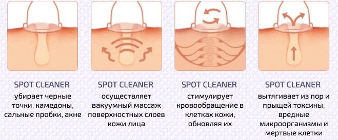 Làm sạch mặt cơ học: siêu âm, thủ công, phần cứng