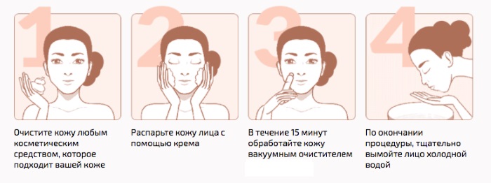 Làm sạch mặt cơ học: siêu âm, thủ công, phần cứng