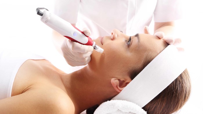 Liệu pháp mesotherapy mặt. Nó là gì, tiêm, không tiêm, hình ảnh, giá của thủ tục