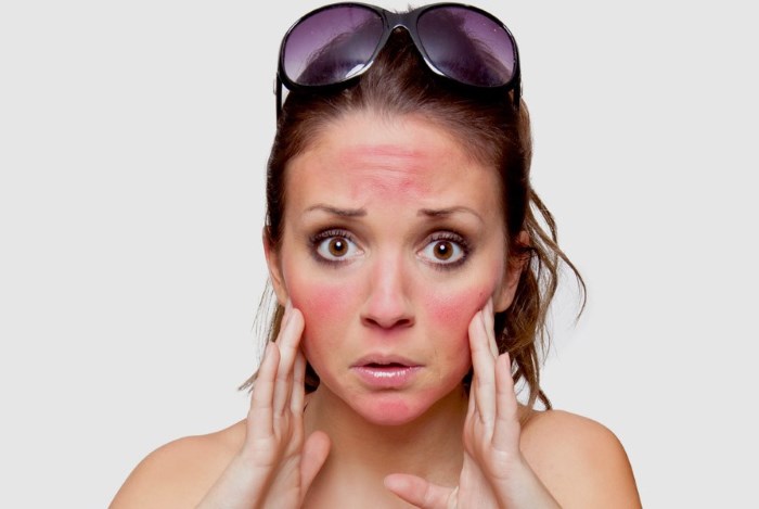 Mesotherapy của khuôn mặt. Nó là gì, tiêm, không tiêm, hình ảnh, giá của thủ tục