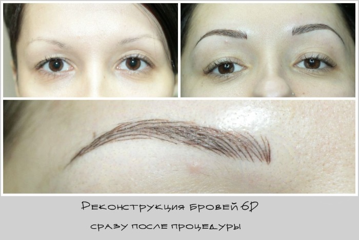 Microblading lông mày - nó là gì, nó được thực hiện như thế nào, đánh giá, ảnh trước và sau