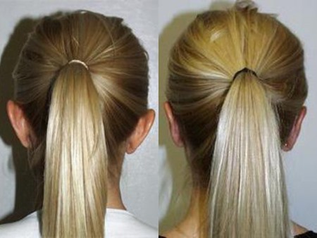 Otoplasty ของหูที่ยื่นออกมา