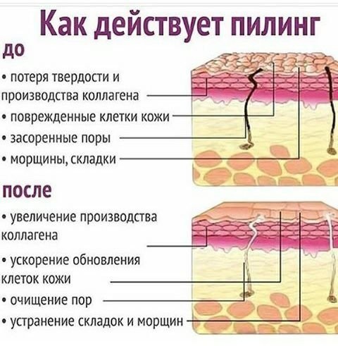 Жути пилинг, ретиноик - шта је то, како то учинити код куће