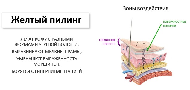 Жути пилинг, ретиноик - шта је то, како то учинити код куће
