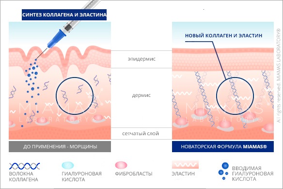Bioreparation - nó là gì, hoạt động của quy trình, tác dụng, những loại thuốc được sử dụng: Gialripier, Aquashine, hình ảnh, giá cả, đánh giá