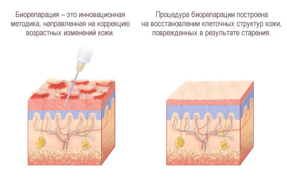 Bioreparation - nó là gì, hoạt động của quy trình, tác dụng, những loại thuốc được sử dụng: Gialripier, Aquashine, hình ảnh, giá cả, đánh giá