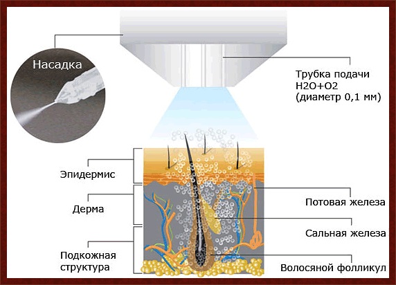 Bioreparation - nó là gì, hoạt động của quy trình, tác dụng, những loại thuốc được sử dụng: Gialripier, Aquashine, hình ảnh, giá cả, đánh giá