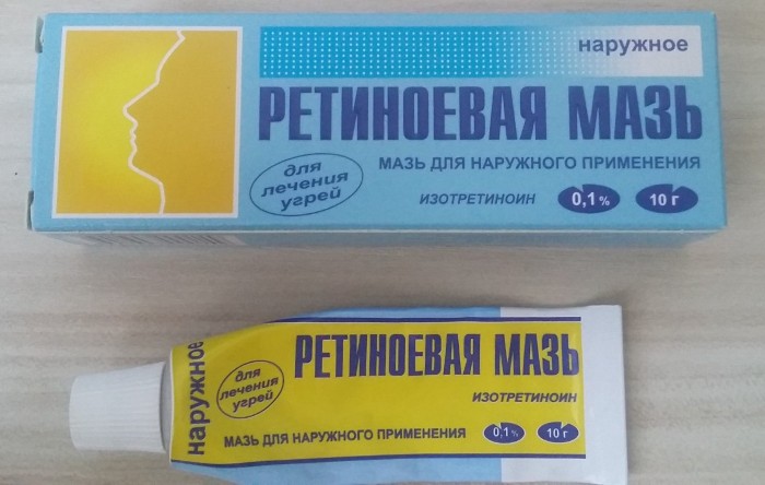 Црне тачке на носу. Како се ослободити комедона народним лековима, маскама, мастима, паром, биљним декокцијама, пилингом
