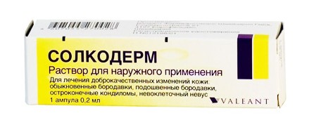 Како се отарасити папилома, уклањање ласером на врату, телу, лицу, интимним местима. Кућно лечење