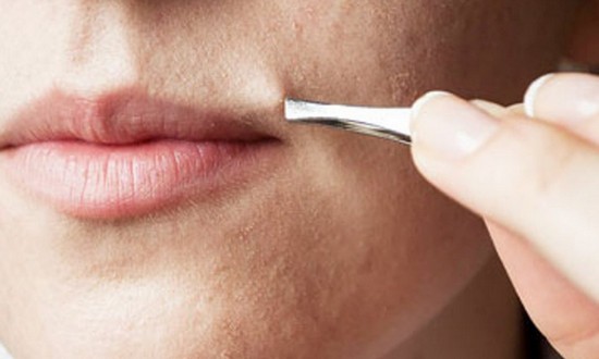 Como se livrar dos pelos faciais de uma mulher para sempre. Remoção de cabelo com remédios populares, depilação com cera, shugaring. Causas e tratamento de pelos faciais excessivos