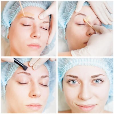 Como se livrar dos pelos faciais de uma mulher para sempre. Remoção de cabelo com remédios populares, depilação com cera, shugaring. Causas e tratamento de pelos faciais excessivos