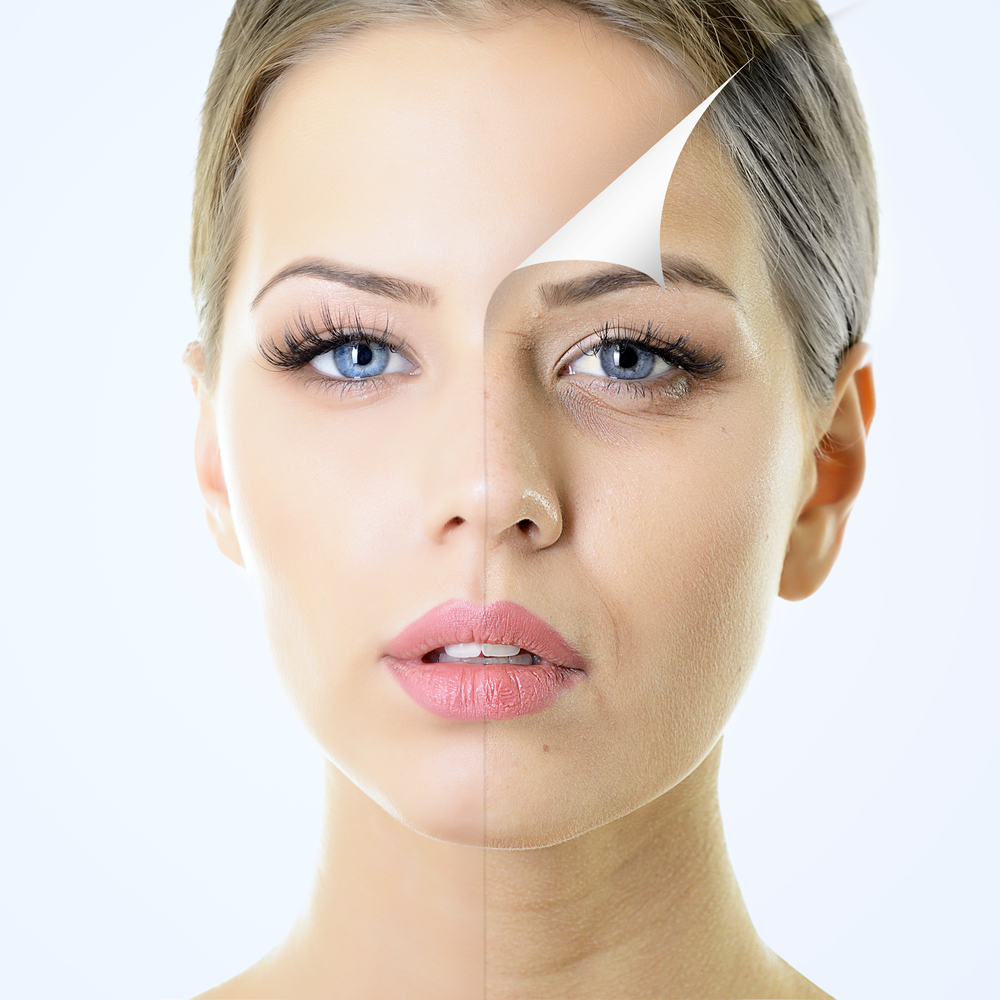 Nâng môi bằng axit hyaluronic. Hình ảnh trước và sau khi làm thủ thuật, đánh giá. Tiêm bao nhiêu tiền