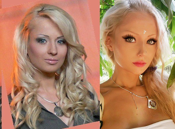 Lukyanova Valeria ก่อนและหลังพลาสติก ภาพถ่ายของสาวบาร์บี้ (Amatue) บนอินสตาแกรม Vkontakte