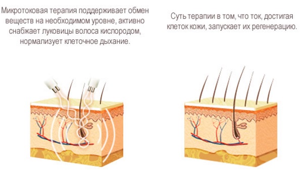 Dòng điện vi mô cho khuôn mặt trong thẩm mỹ - một quy trình trị liệu bằng máy. Giá cả, đánh giá