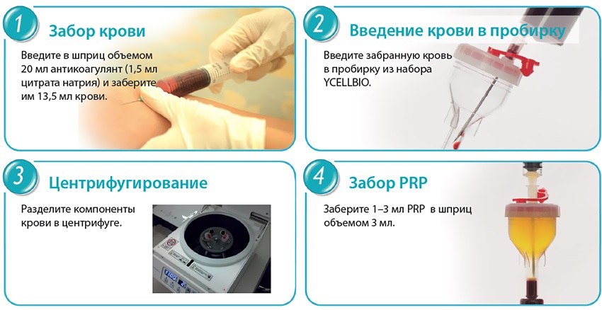 Liệu pháp Plasma - Plasmolifting của da mặt và cổ, chỉ định, chống chỉ định, hình ảnh, giá của thủ thuật, đánh giá