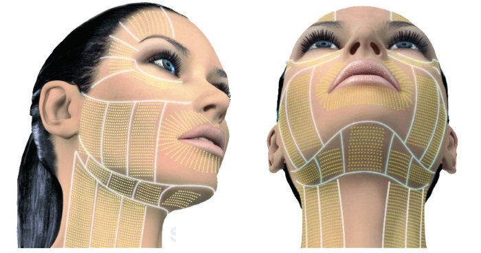 Liệu pháp Plasma - Plasmolifting của da mặt và cổ, chỉ định, chống chỉ định, hình ảnh, giá của thủ thuật, đánh giá