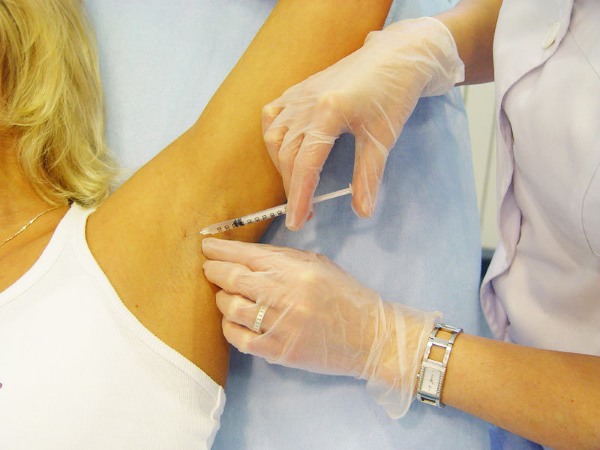 Botox cho mặt là gì, tiêm, tiêm nano botox ở trán, nếp gấp rãnh mũi má, nách