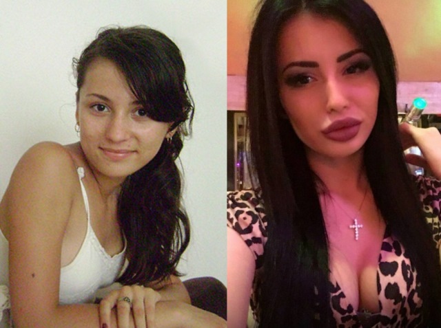 Lilya Chertraru - صور قبل وبعد ، سيرة ذاتية ، House 2 ، Instagram ، VK