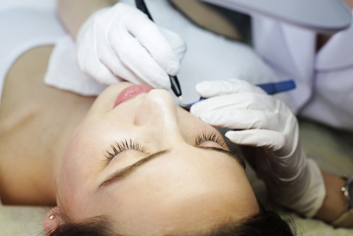 Elektrolisis - apa itu, bagaimana ia dilakukan, penyingkiran rambut perkakasan. Foto sebelum dan selepas