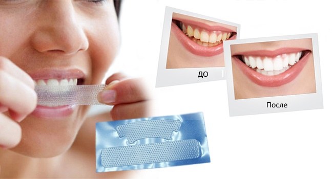 Como clarear os dentes em casa sem agredir o esmalte rapidamente por causa do amarelecimento. Produtos e receitas populares