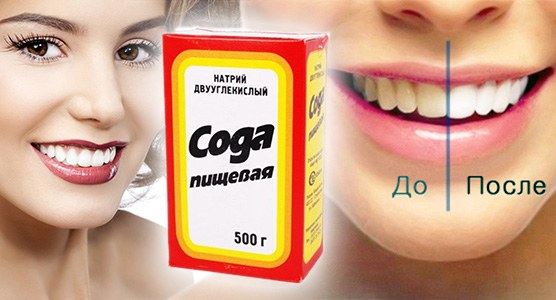 Como clarear os dentes em casa sem agredir o esmalte rapidamente por causa do amarelecimento. Produtos e receitas populares