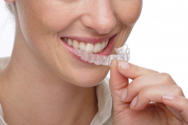 Como clarear os dentes em casa sem agredir o esmalte rapidamente por causa do amarelecimento. Produtos e receitas populares