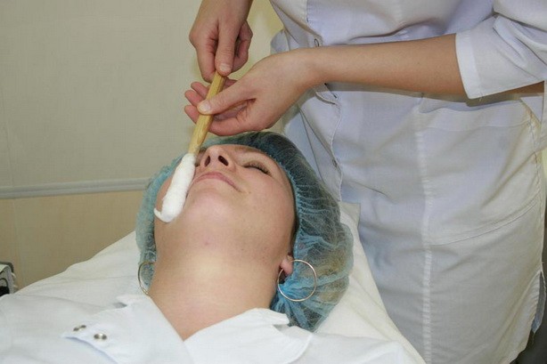 Parut keloid selepas pembedahan - apa itu dan mengapa ia berbahaya? Apa rupa parut keloid. Gambar