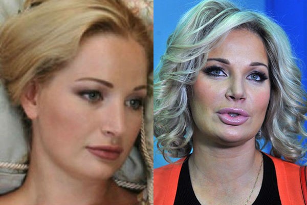 Maria Maksakova ảnh trước và sau phẫu thuật thẩm mỹ. Tiểu sử và đời tư, các con của một ca sĩ opera. Phẫu thuật thẩm mỹ